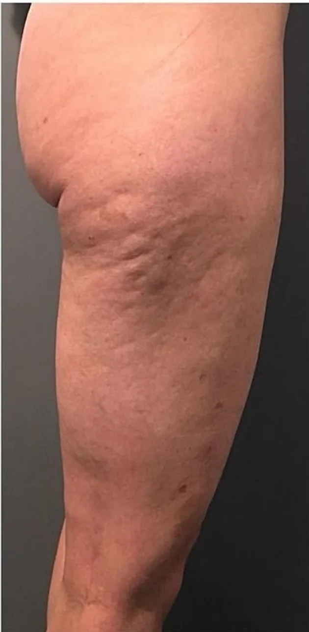 Client treatment area before Body Reset care at LESIQUE SPA.